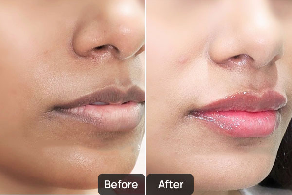 Top Dermatologist in Chandigarh