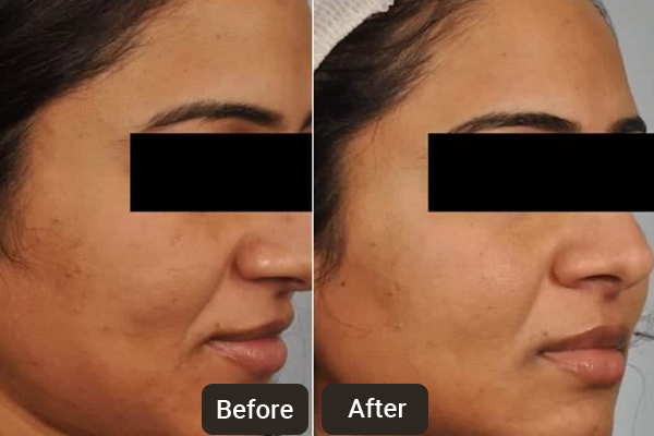 Skin Doctor in Chandigarh