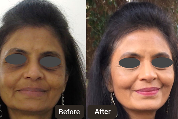 Top Dermatologist in Chandigarh