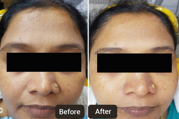 Top Cosmetic Dermatologists in Chandigarh