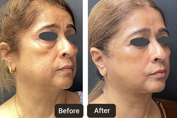 Top Skin & Laser Specialist in Chandigarh